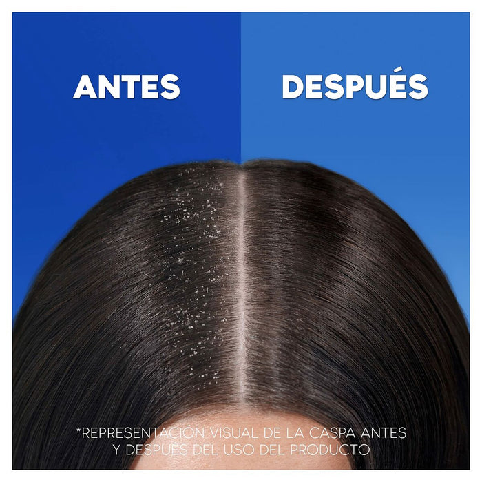 Șampon Head & Shoulders H&S Clásico 1 L