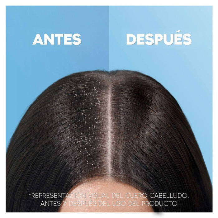 Șampon Head & Shoulders H&S Clásico 1 L
